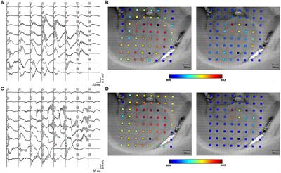 High Frequency Oscillations in Rat Hippocampal Slices: Origin, Frequency Characteristics, and Spread